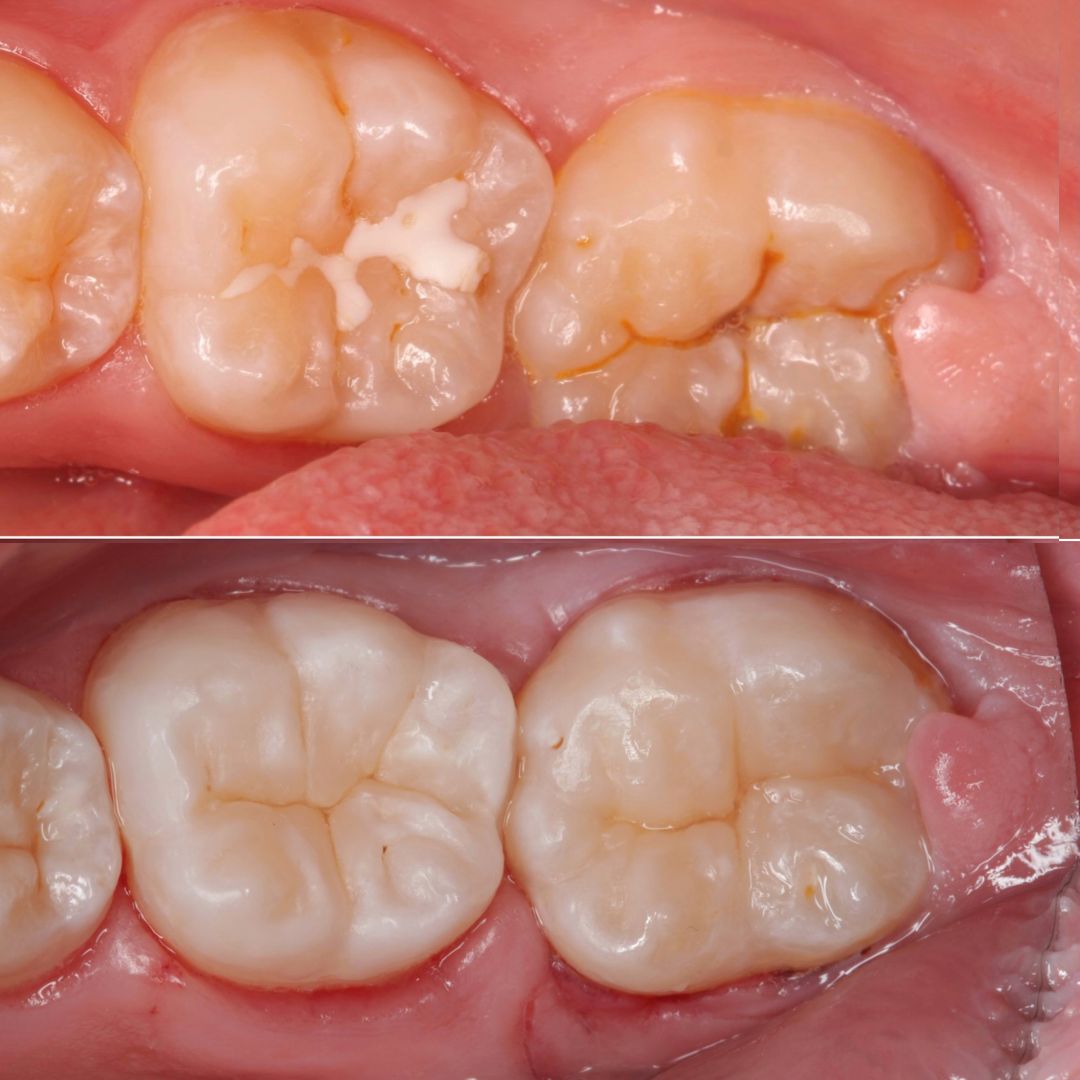 Valeriia Danyliuk-15