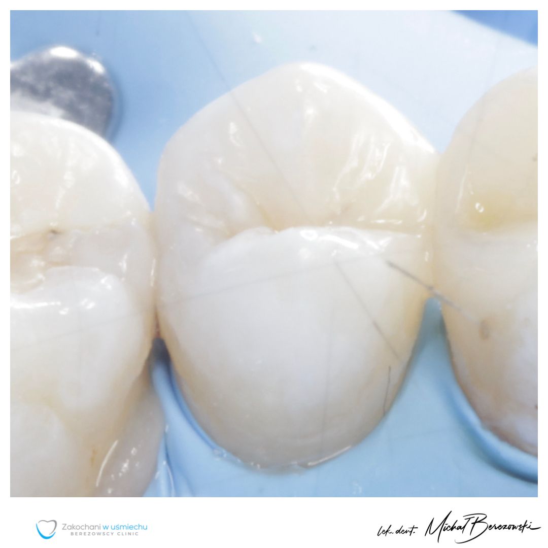 Michał Berezowski-49