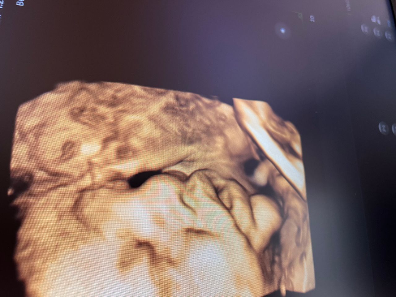 Katarzyna Leszczyńska-16