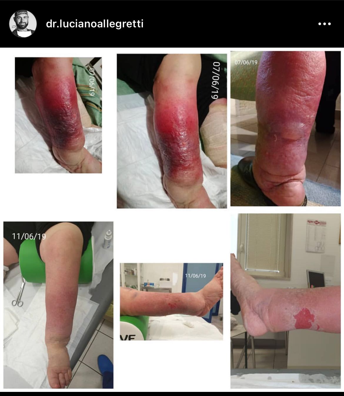 Luciano Allegretti-19