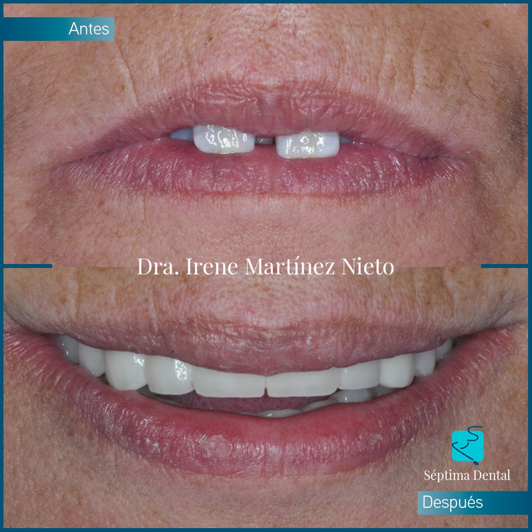 Irene Martinez Nieto-5