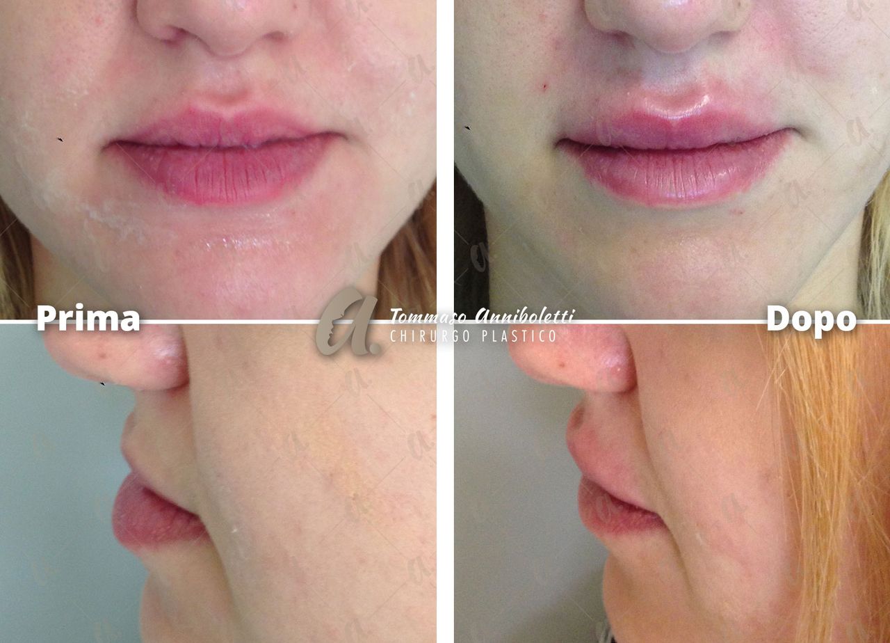 Tommaso Anniboletti-42