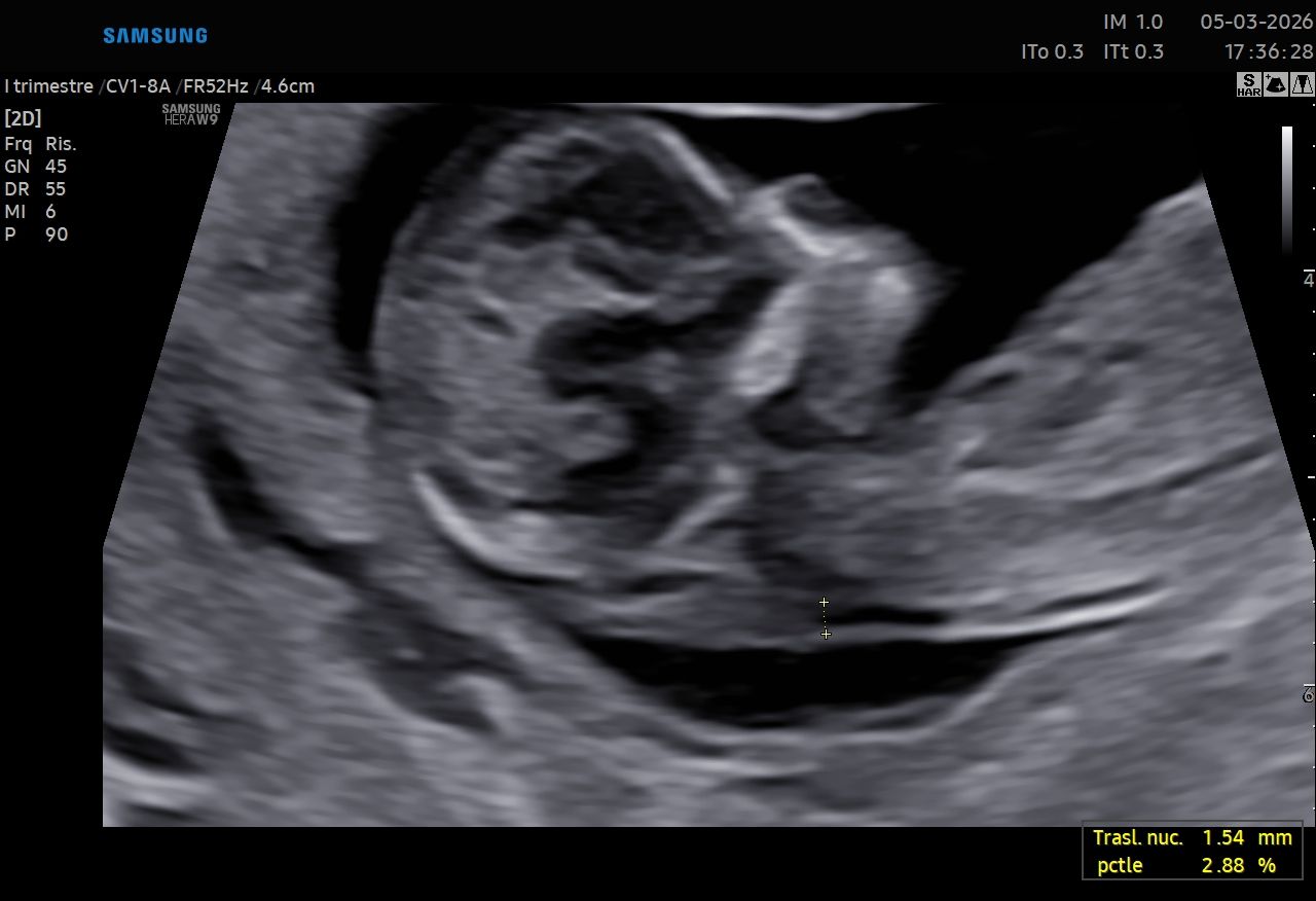 Valentina Del Negro-12