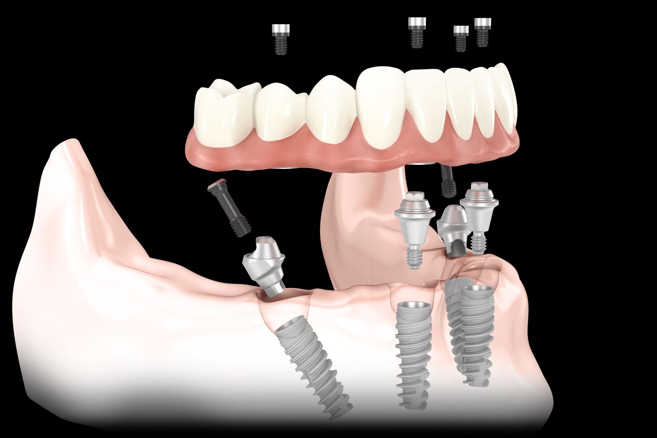 Francesco Anaclerico-4