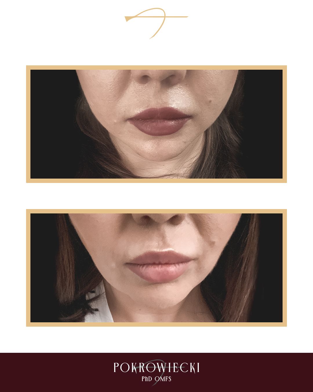 Rafał Pokrowiecki-29