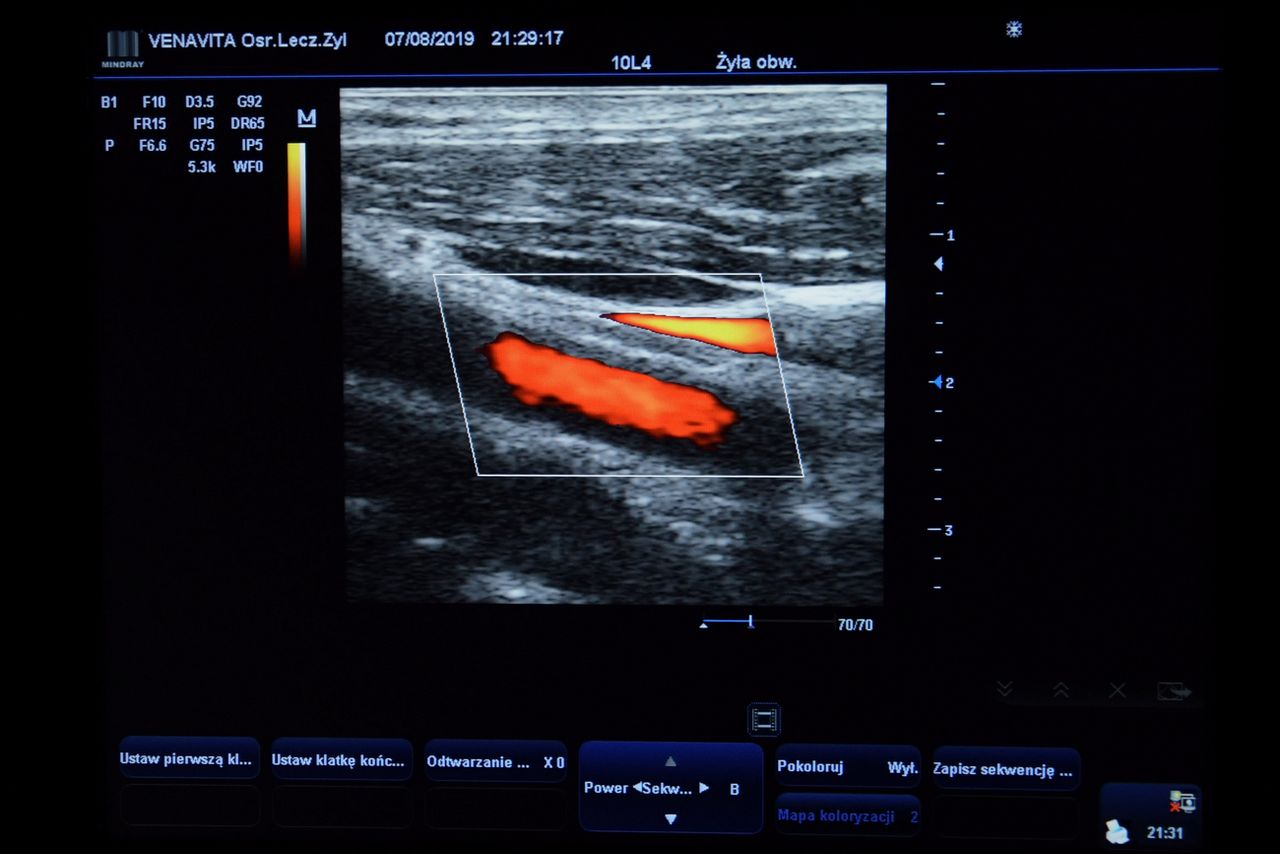 Krzysztof Błachowiak-9