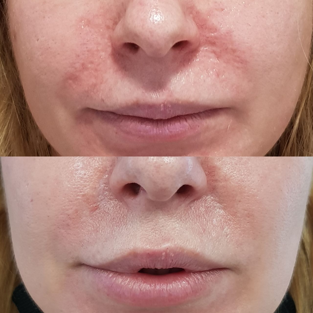 Rosalba Herrero Zerpa-256