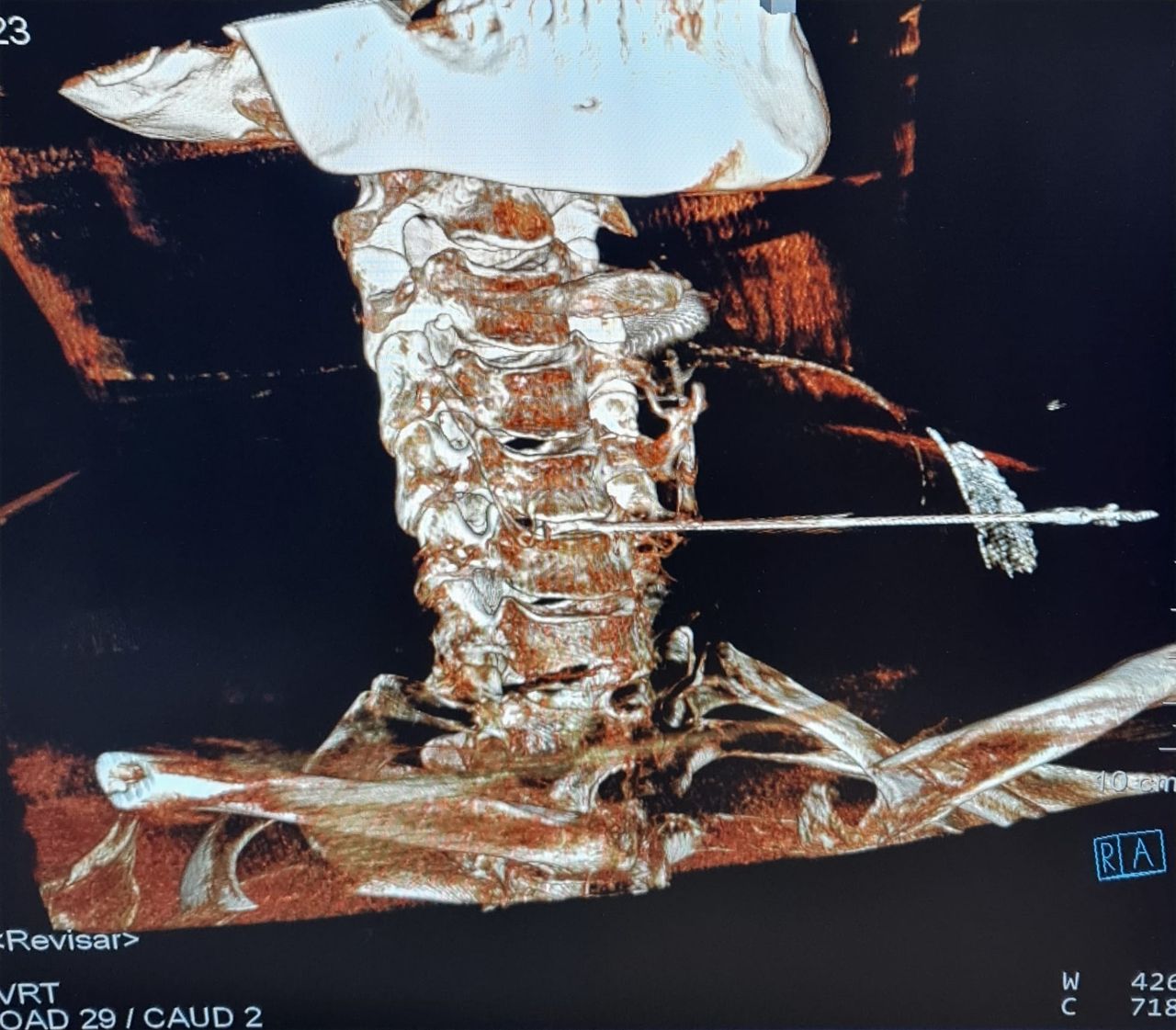 Carlos Morales Portillo-6