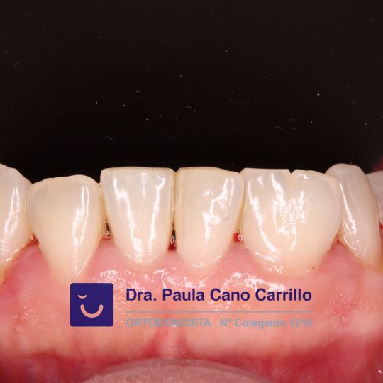 Paula Cano Carrillo-111