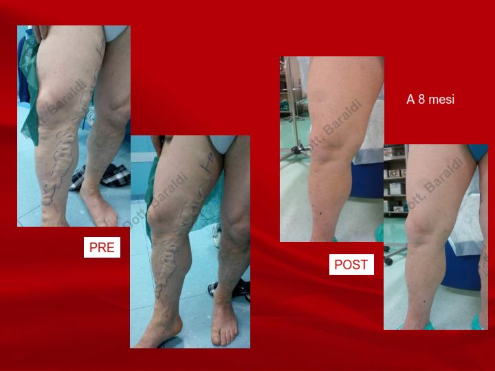 Christian Baraldi-13