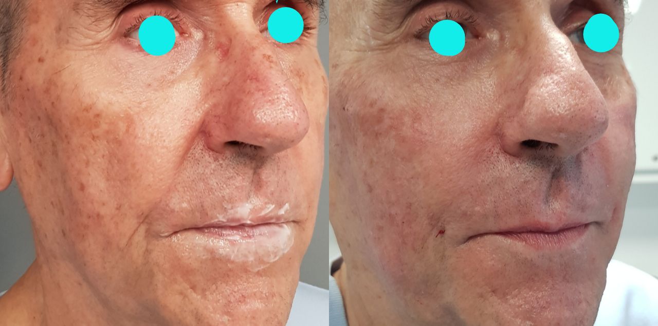 Rosalba Herrero Zerpa-469