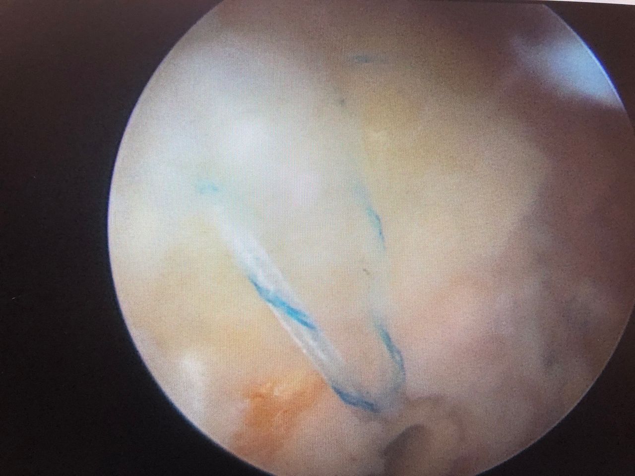 Jonathan Matellanes Higuera-1