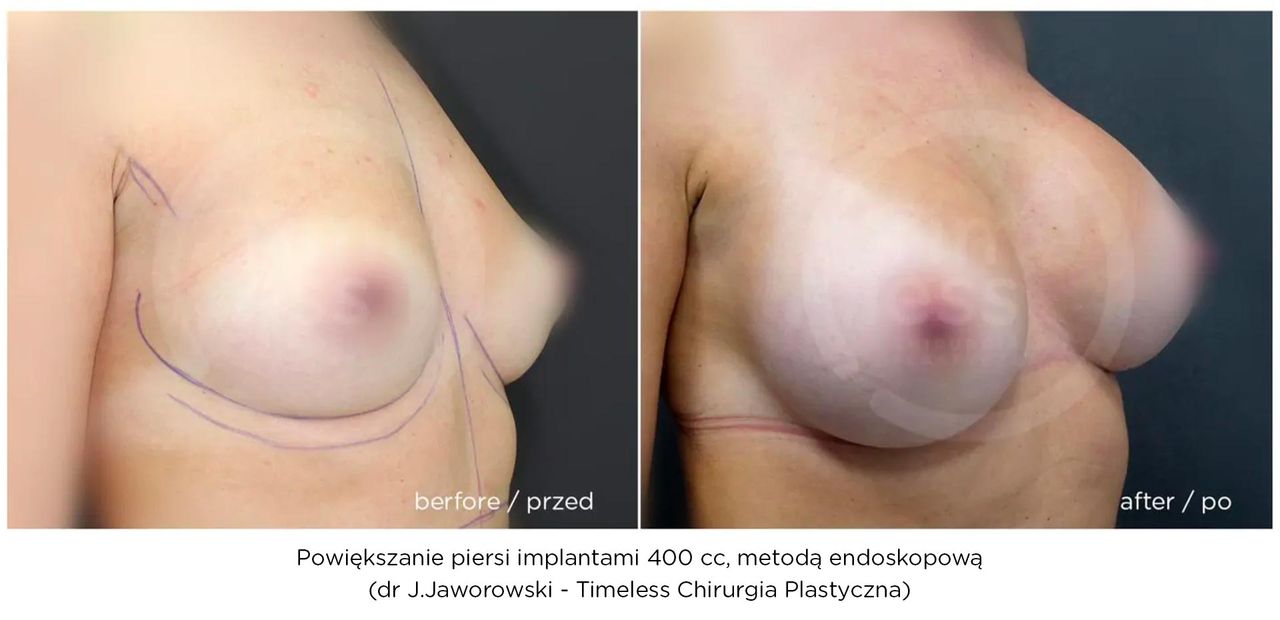 Janusz Jaworowski-103