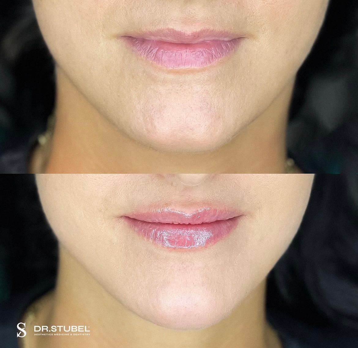 Marco Rizzetto Stubel-5