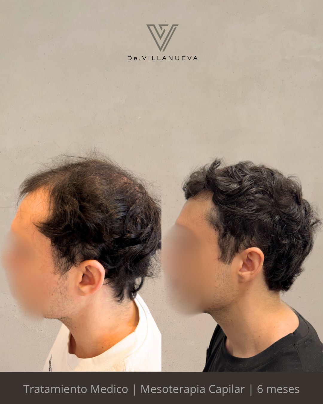 Alfredo Villanueva-14