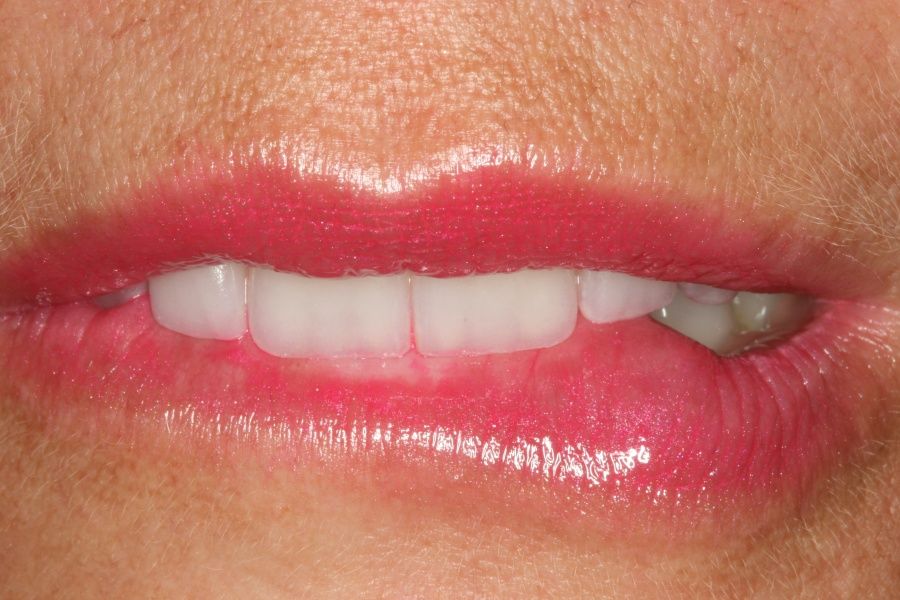 Thomas Zartmann, Msc-5