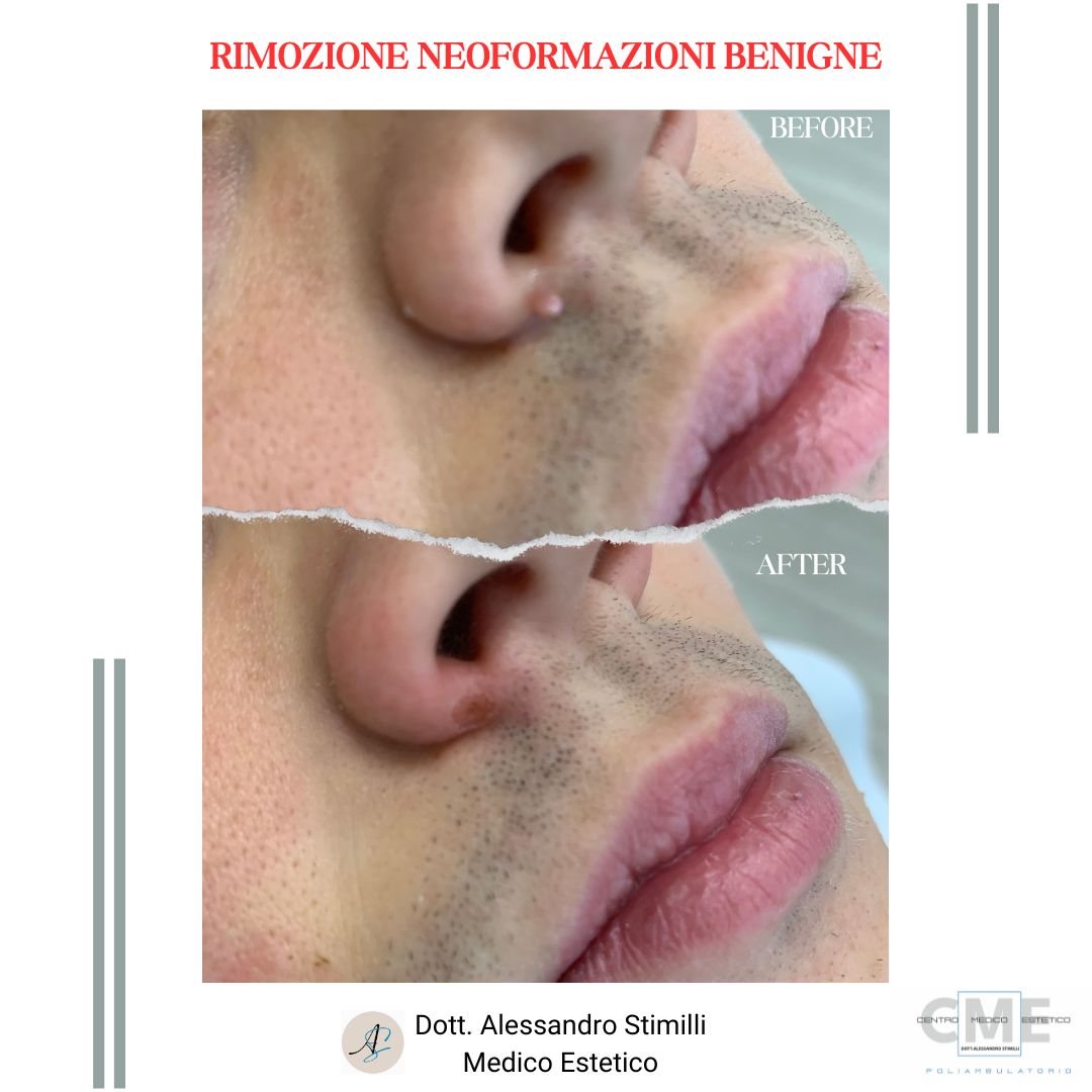 Alessandro Stimilli-6