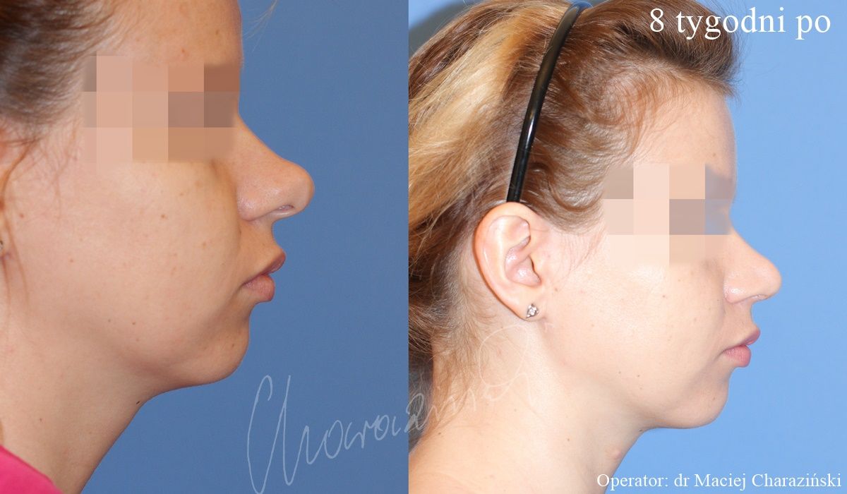 Maciej Charaziński-88