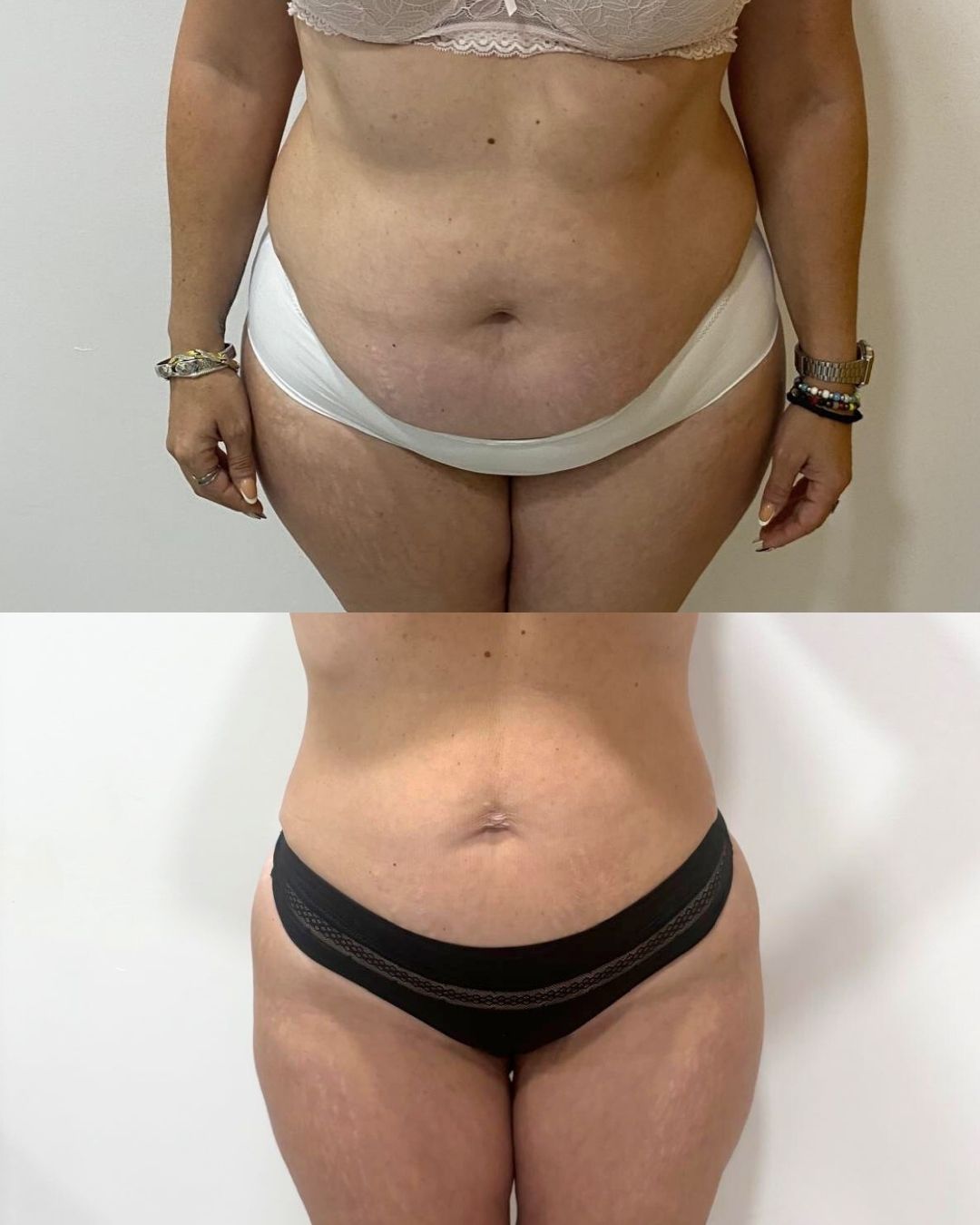 Juan Francisco Belén Montero-23