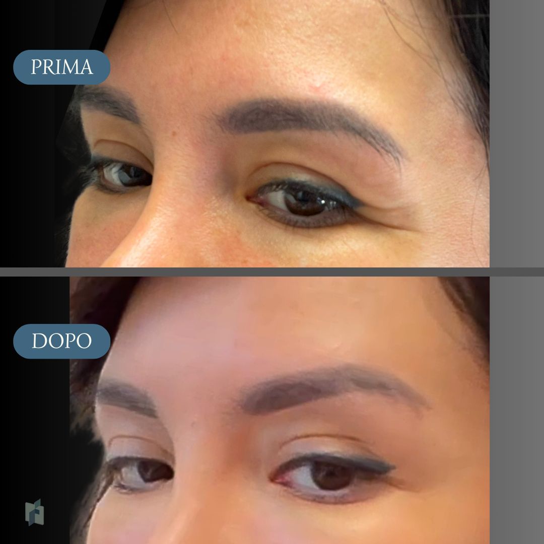 Fioravante Orefice-4