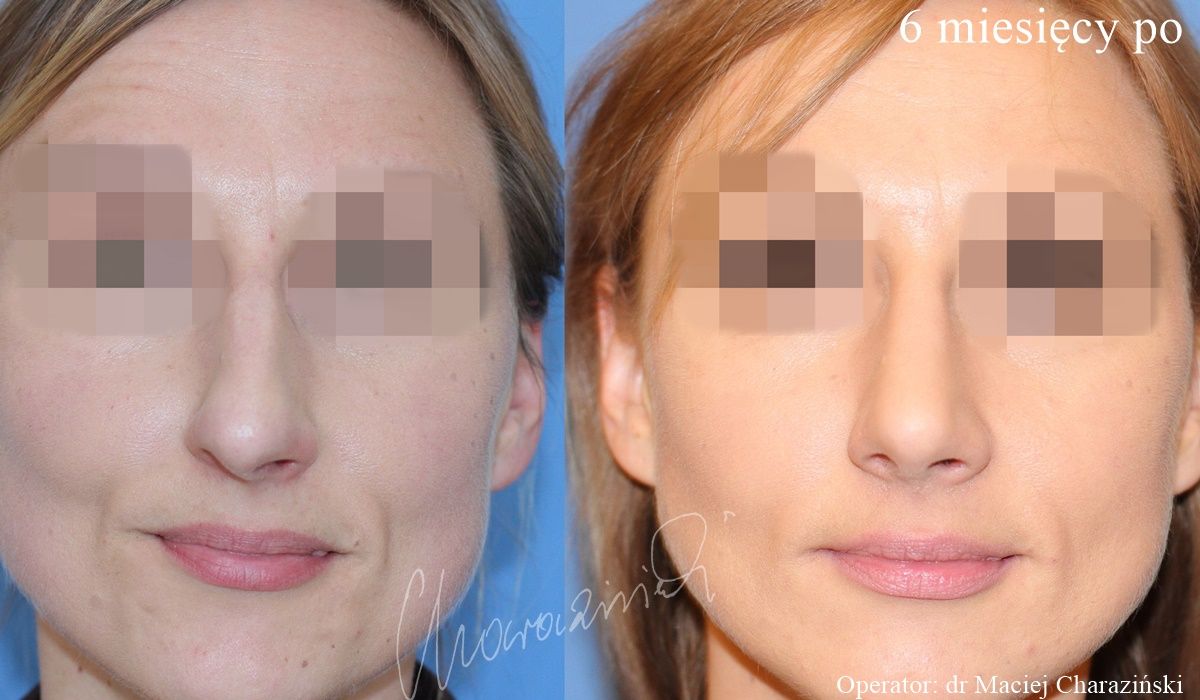 Maciej Charaziński-11