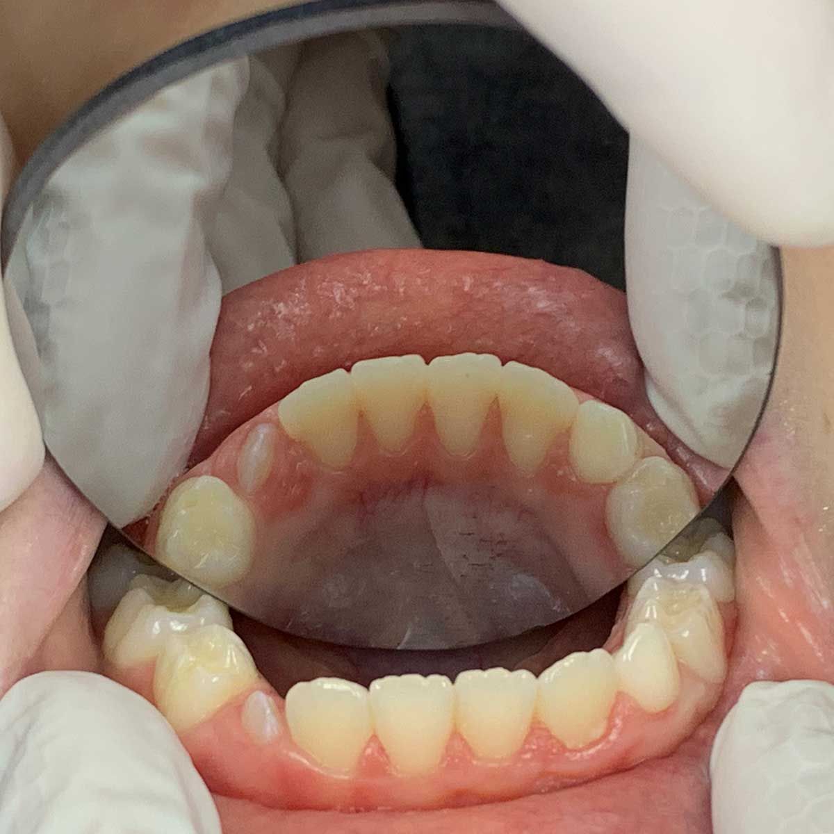 Gianluigi Bittante-17