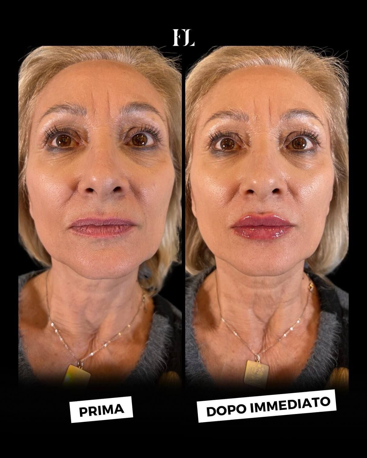 Floriana Lauritano-4