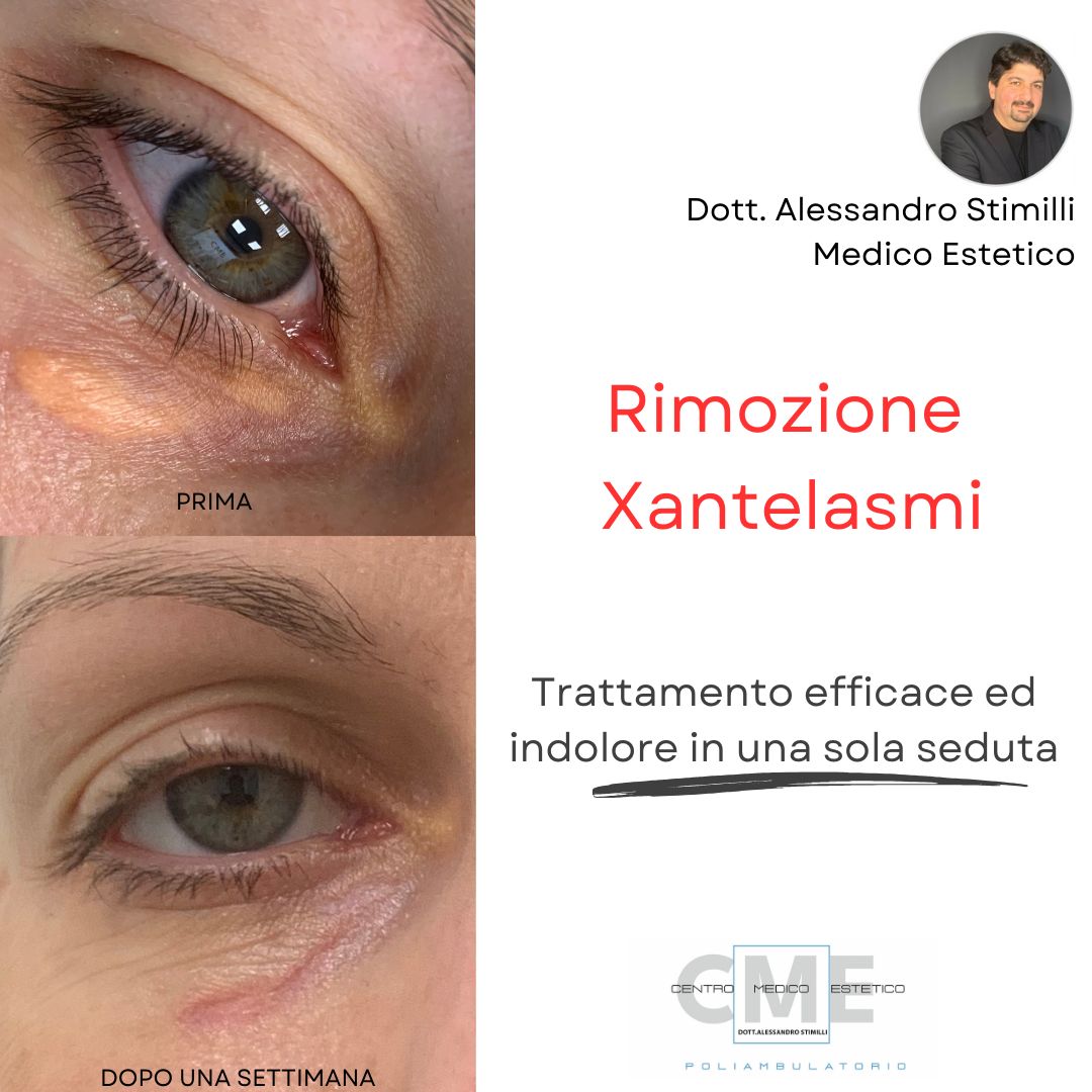 Alessandro Stimilli-11