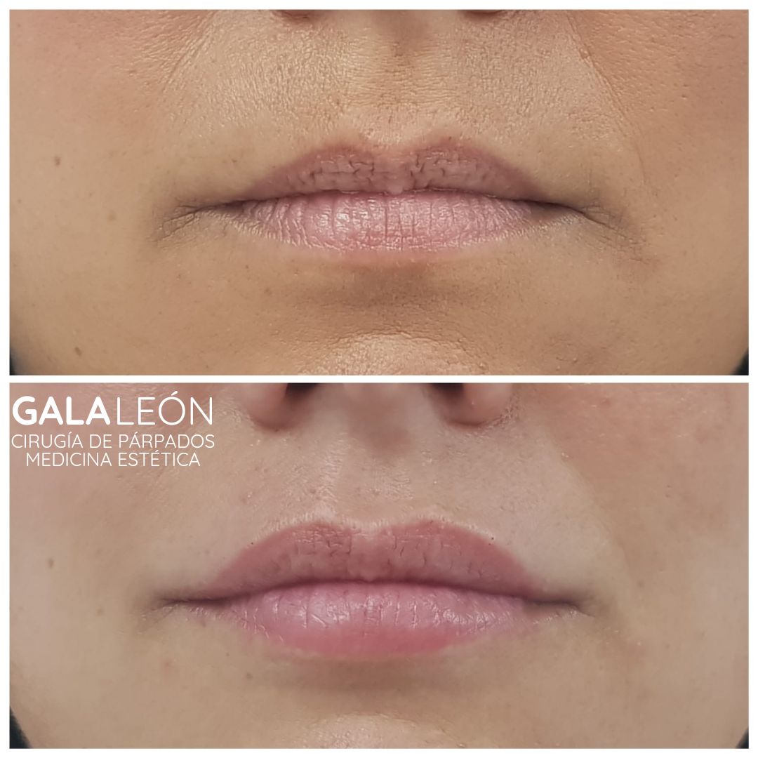 Gala P. Leon Salvatierra-4