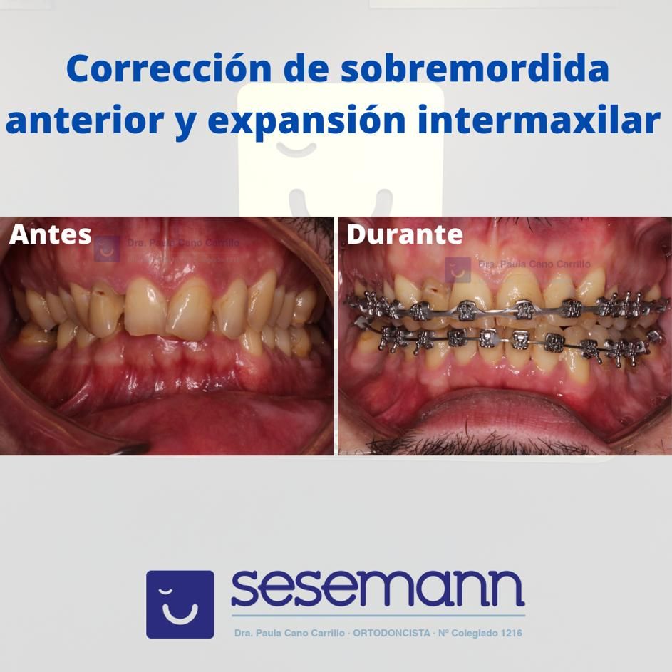 Paula Cano Carrillo-64