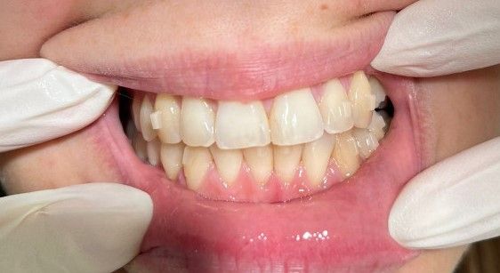 Riunito Dentista Dentalpar-16