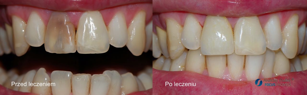 Andrzej Dudek-3