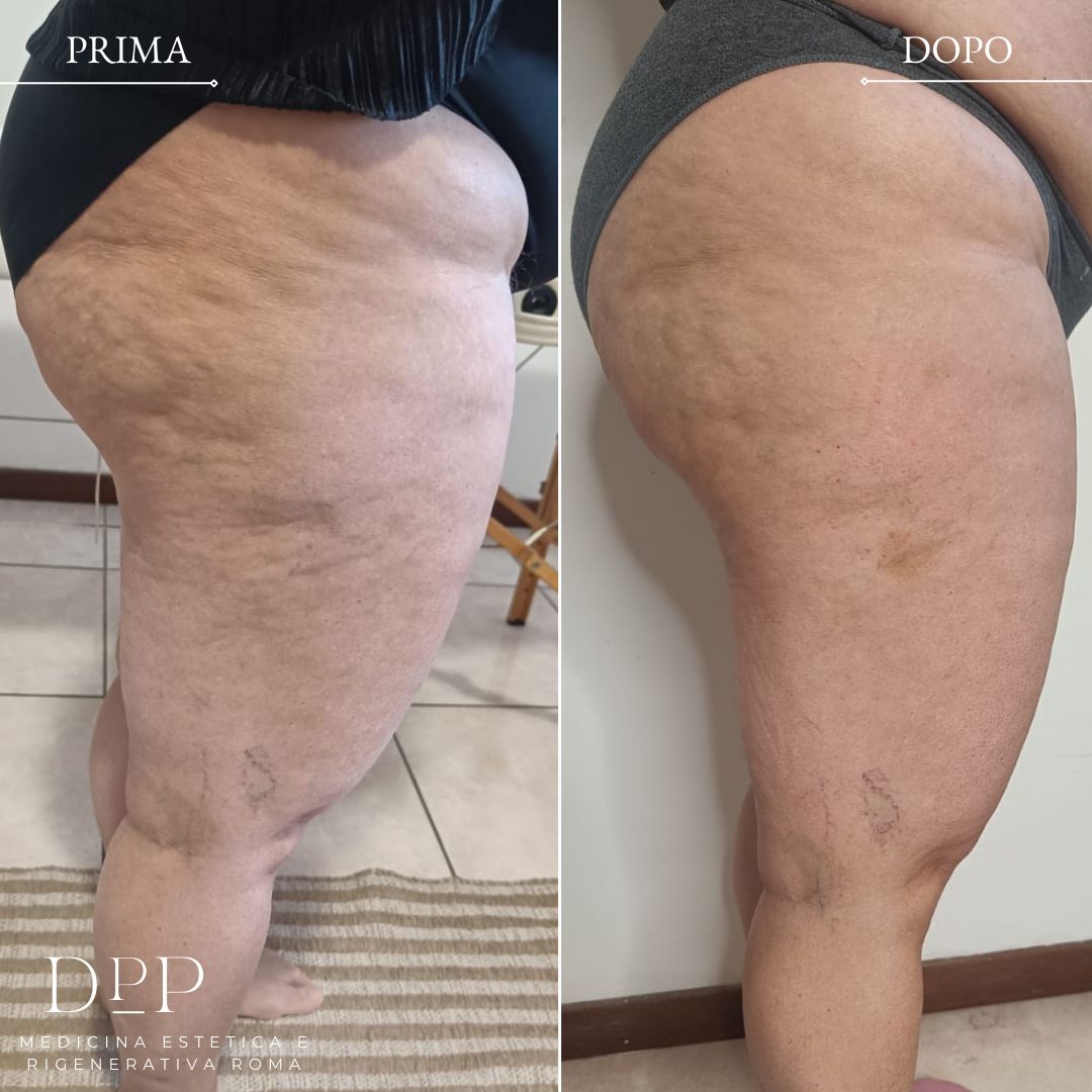 Davide Prosperi Porta-13