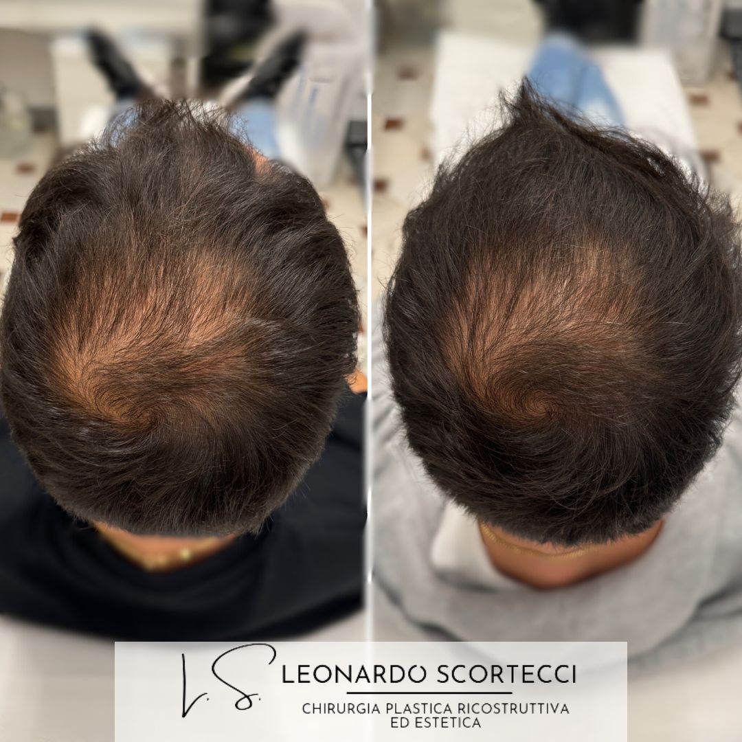 Leonardo Scortecci-11