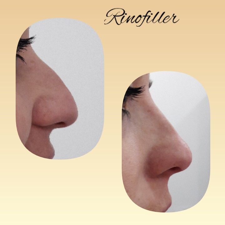 Paola Della Rocca-62