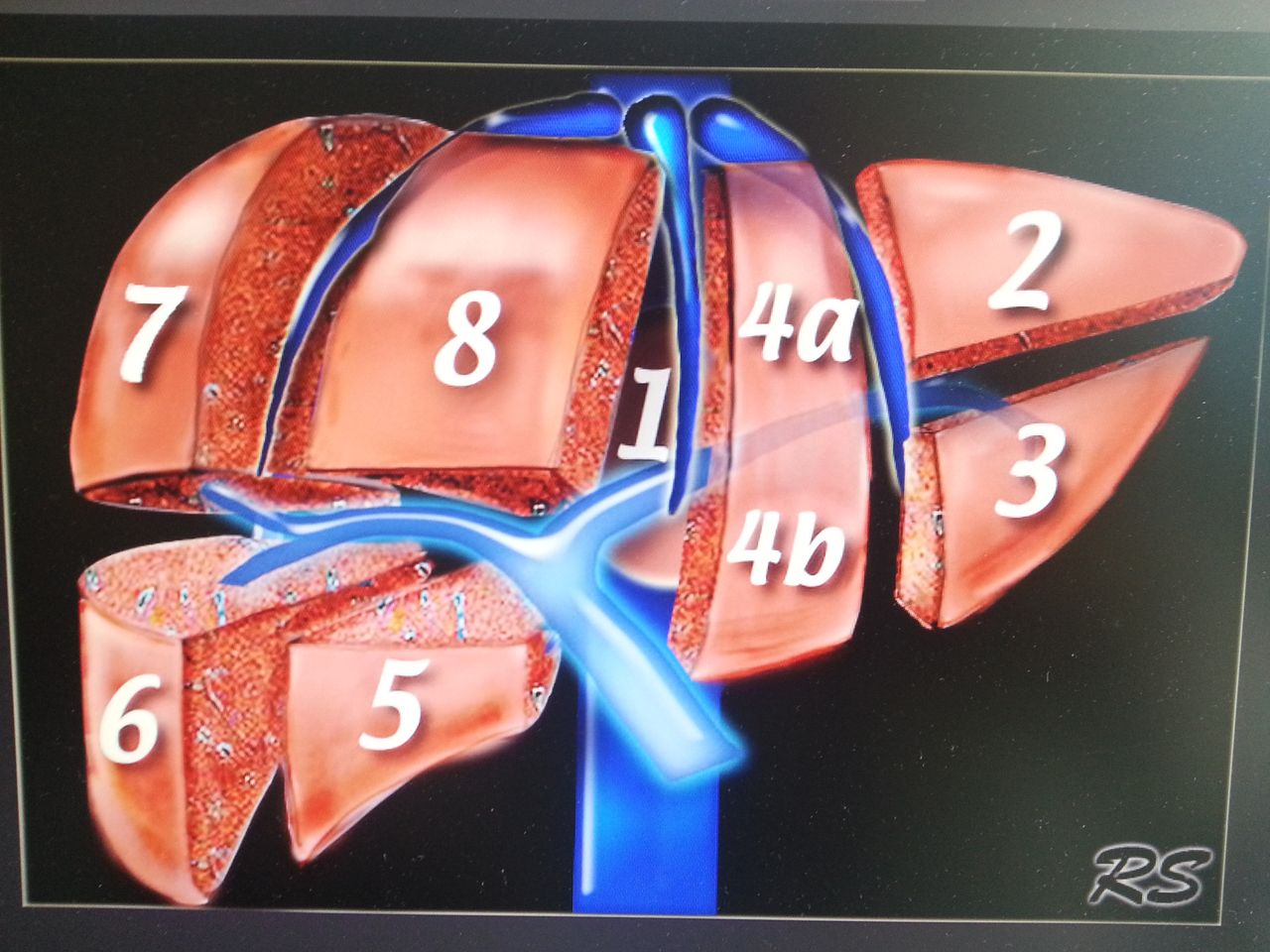 José Antonio Bueno Lledó-11