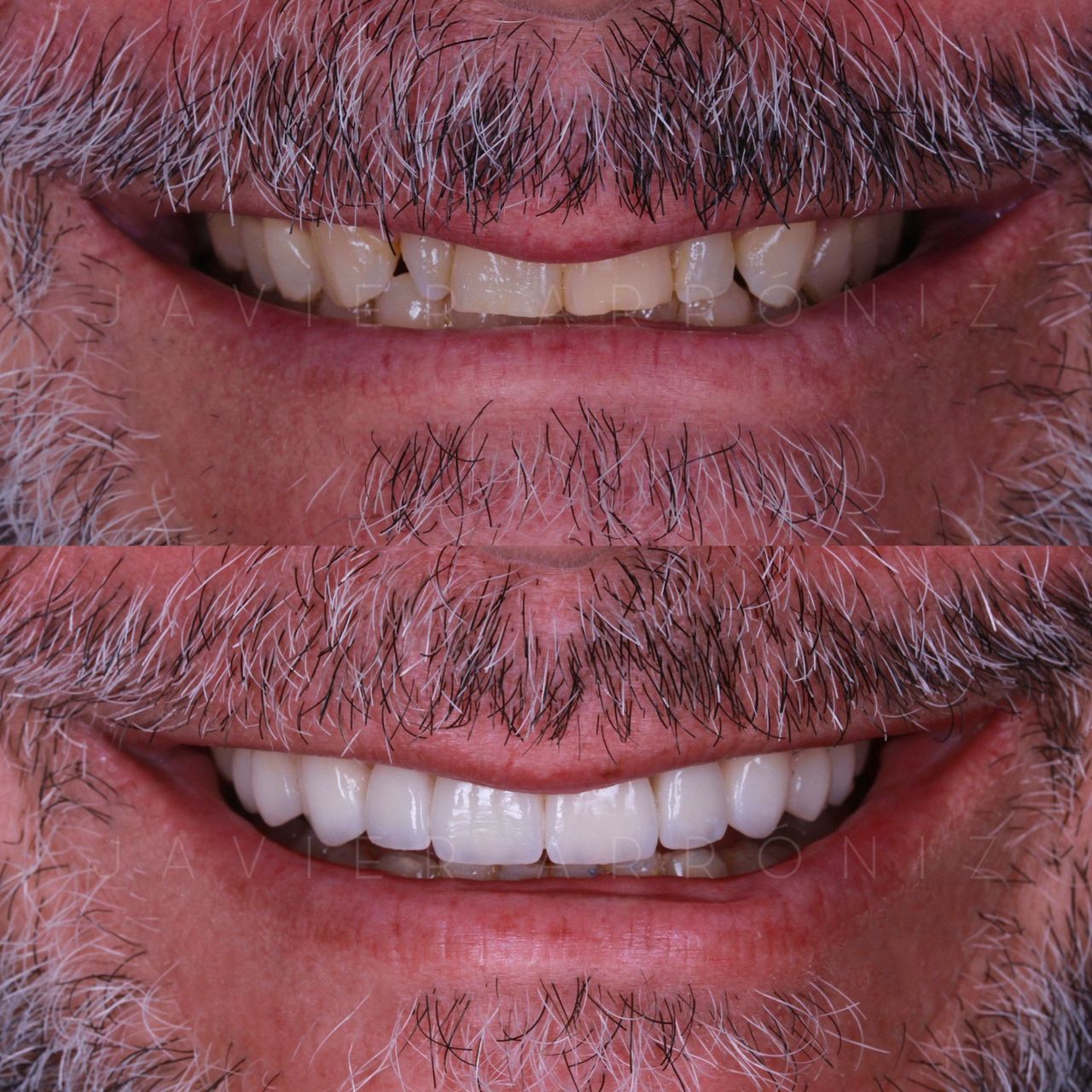 Javier Arroniz Gallego-0