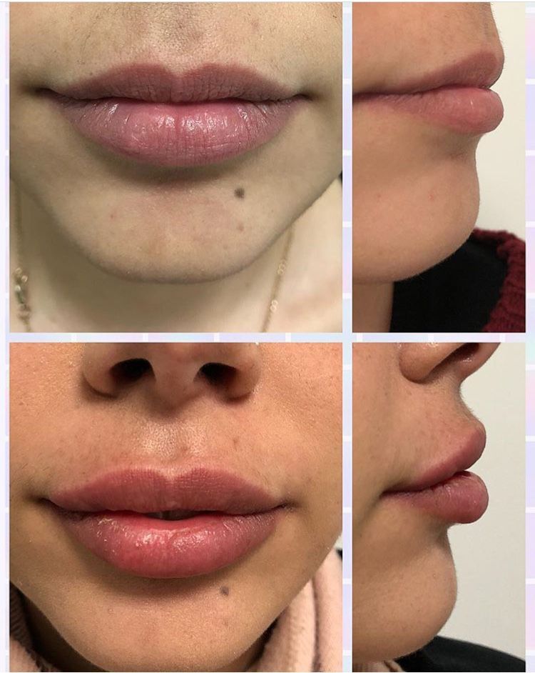 Pasquale Virciglio-19