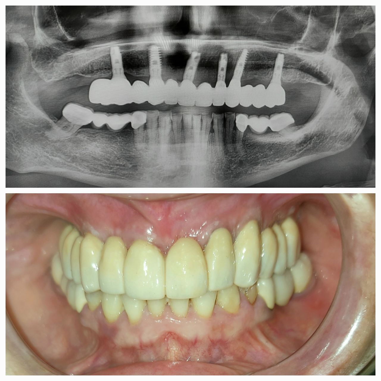 Lorenzo Paolo Bottini-1