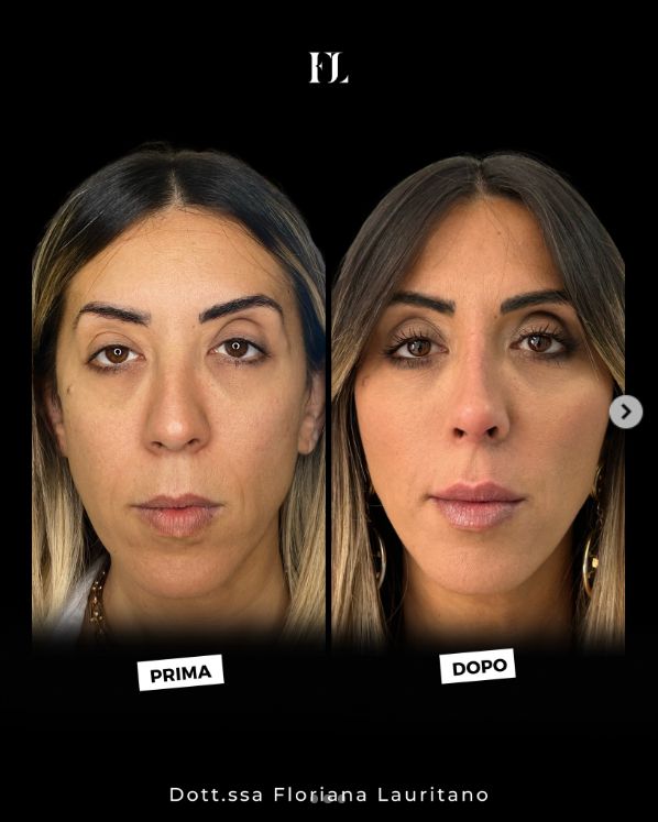 Floriana Lauritano-0