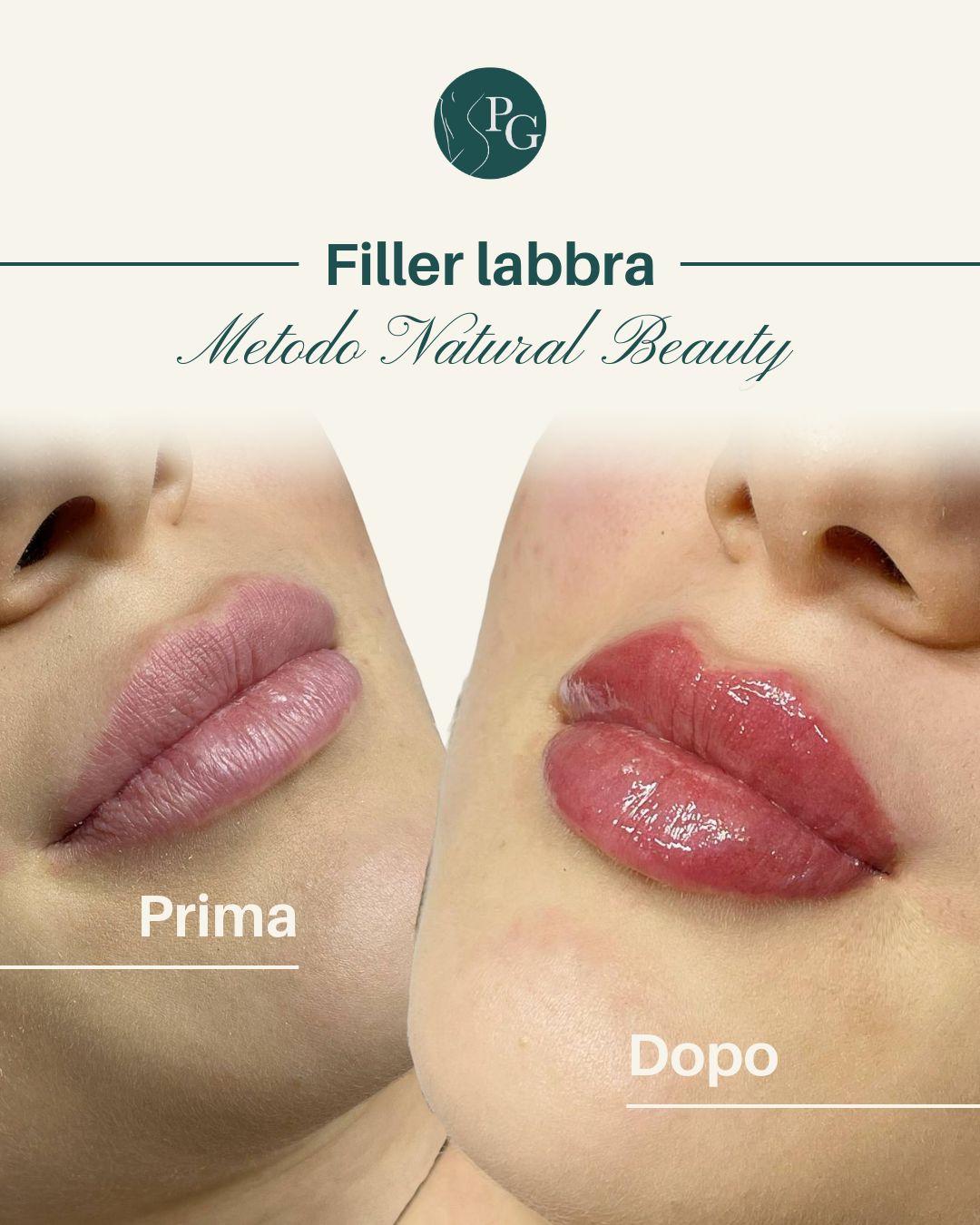 Pasquale Graziano-19