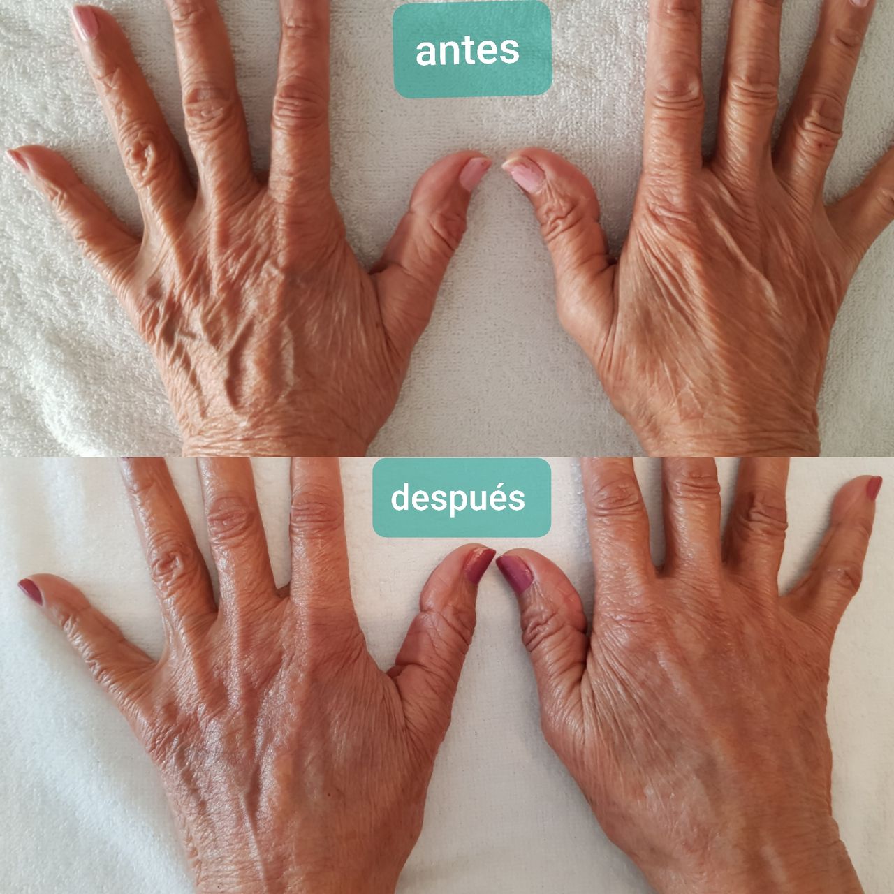 Rosalba Herrero Zerpa-244