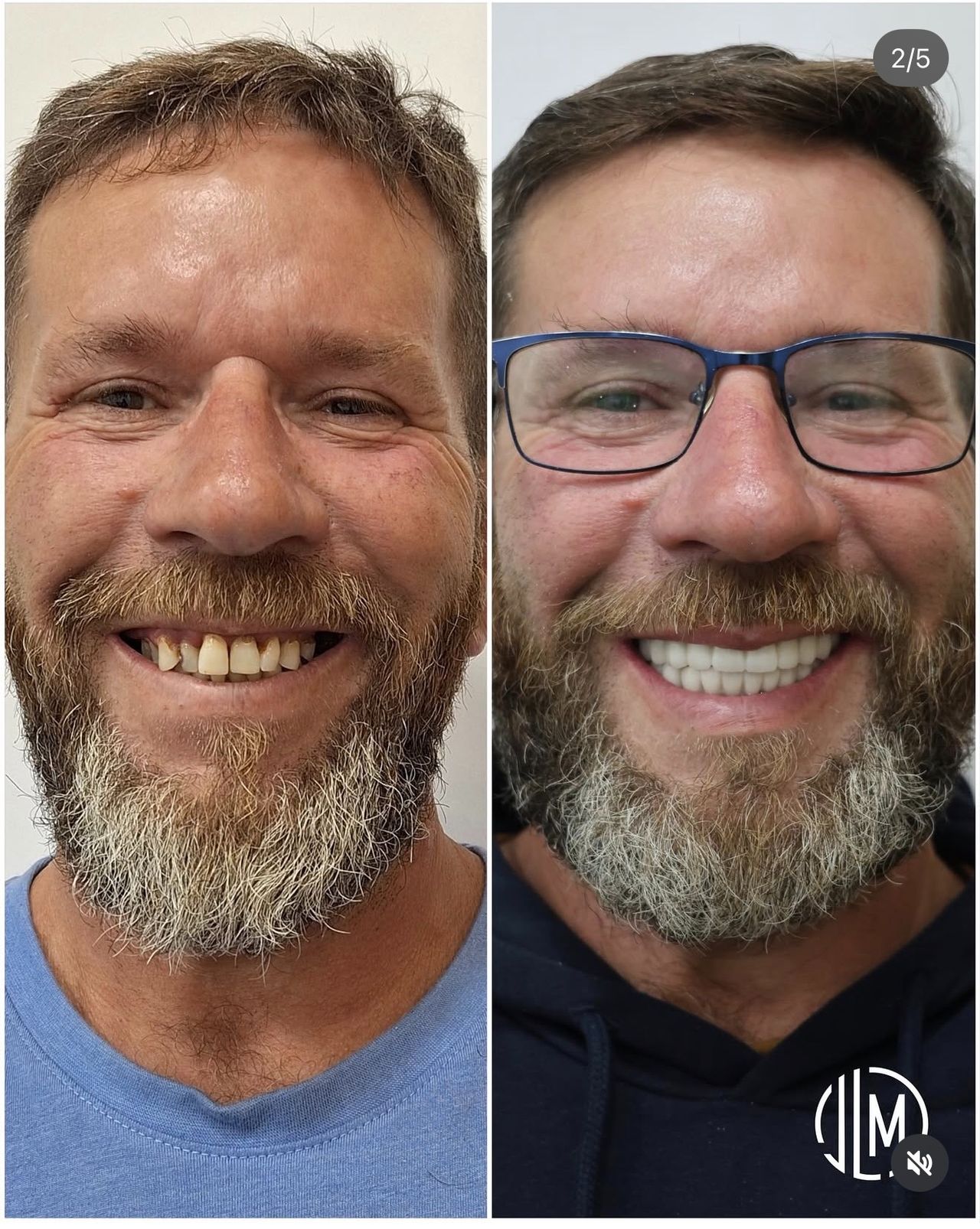 José Luis Mejía Martin-4