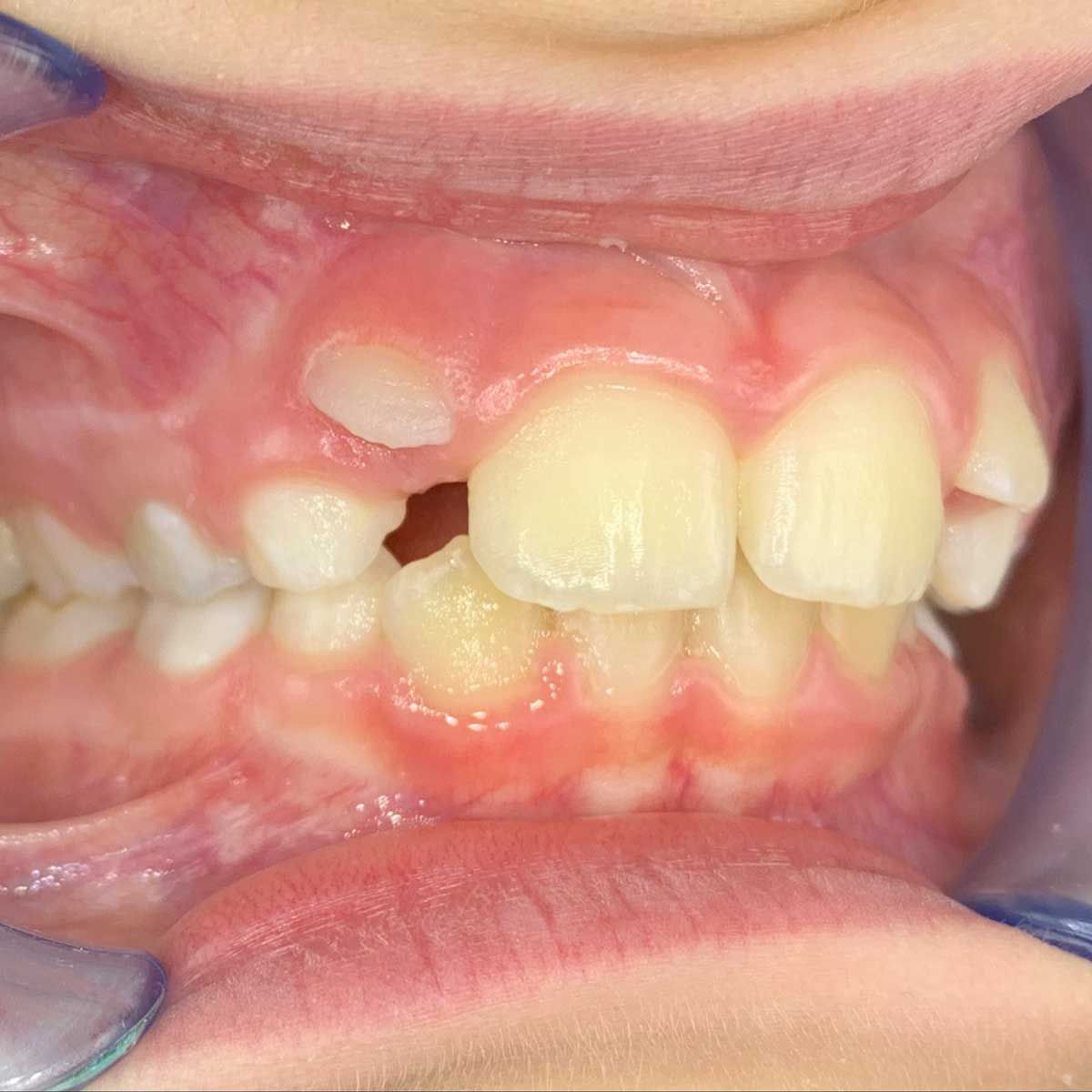 Gianluigi Bittante-39