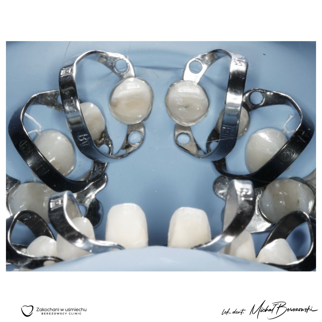 Michał Berezowski-33