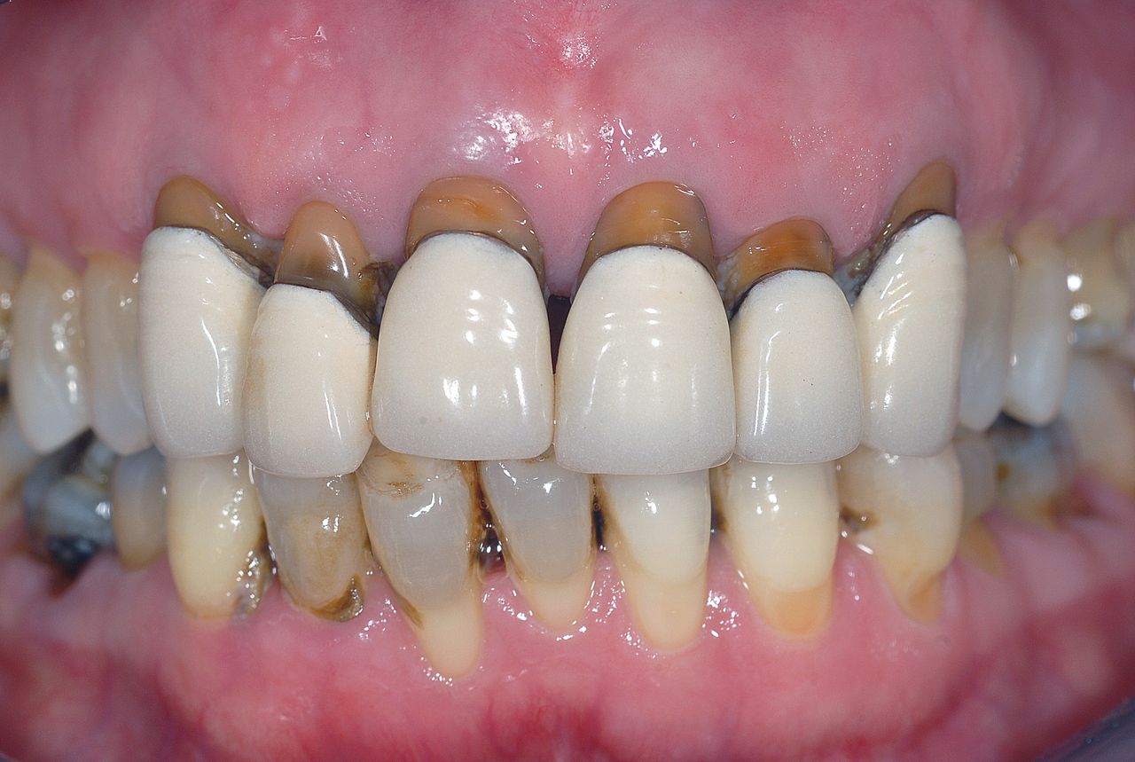 Stefano De Simone-127