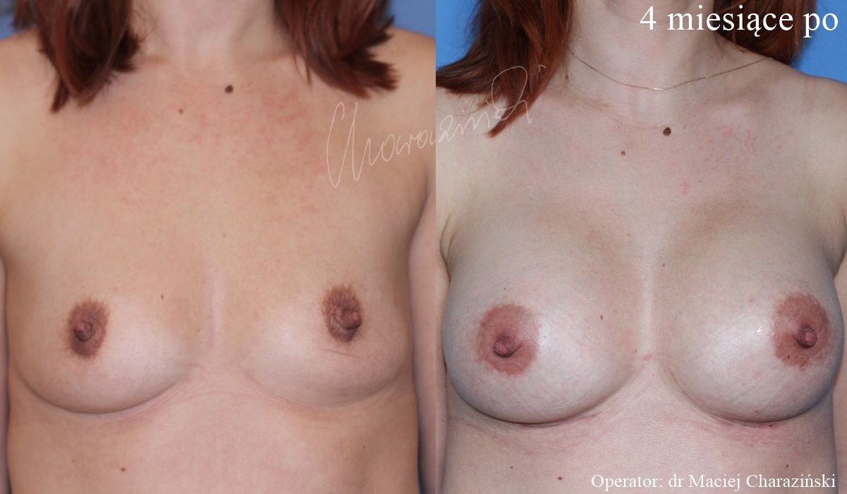 Maciej Charaziński-127