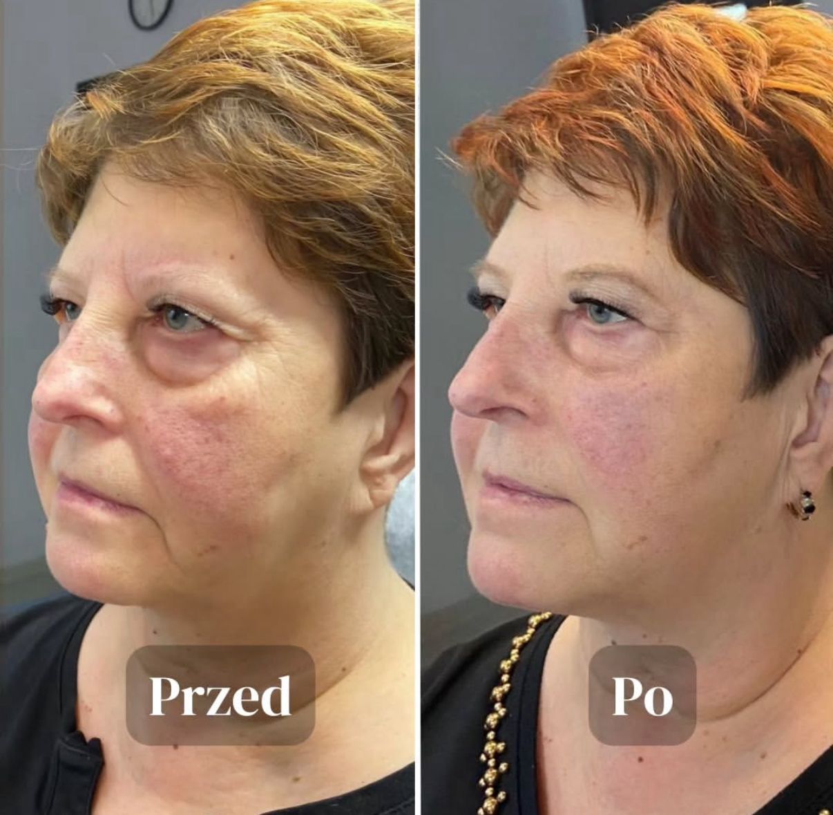 Aleksandra Kowalczuk-9