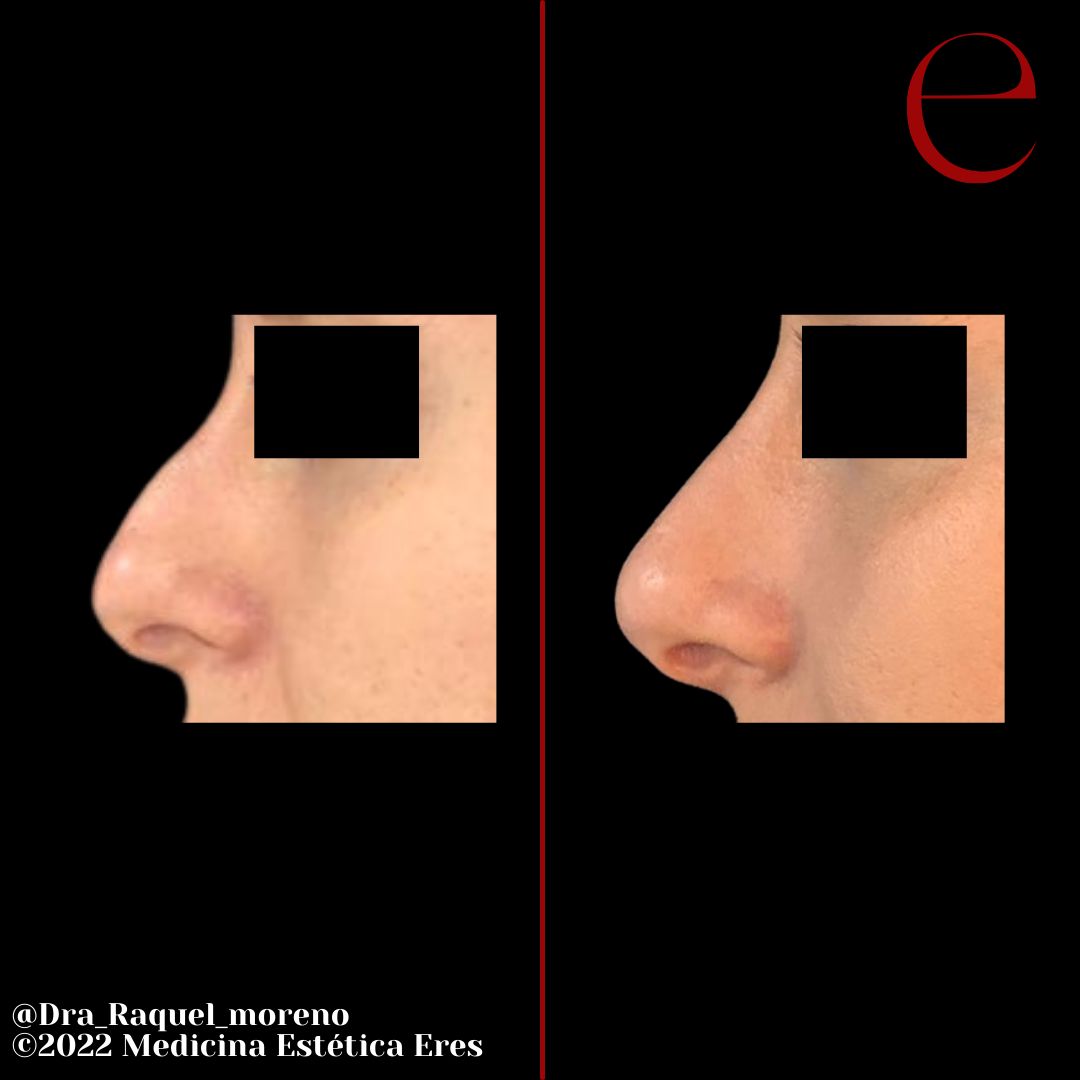 Raquel Moreno Pentinel-94