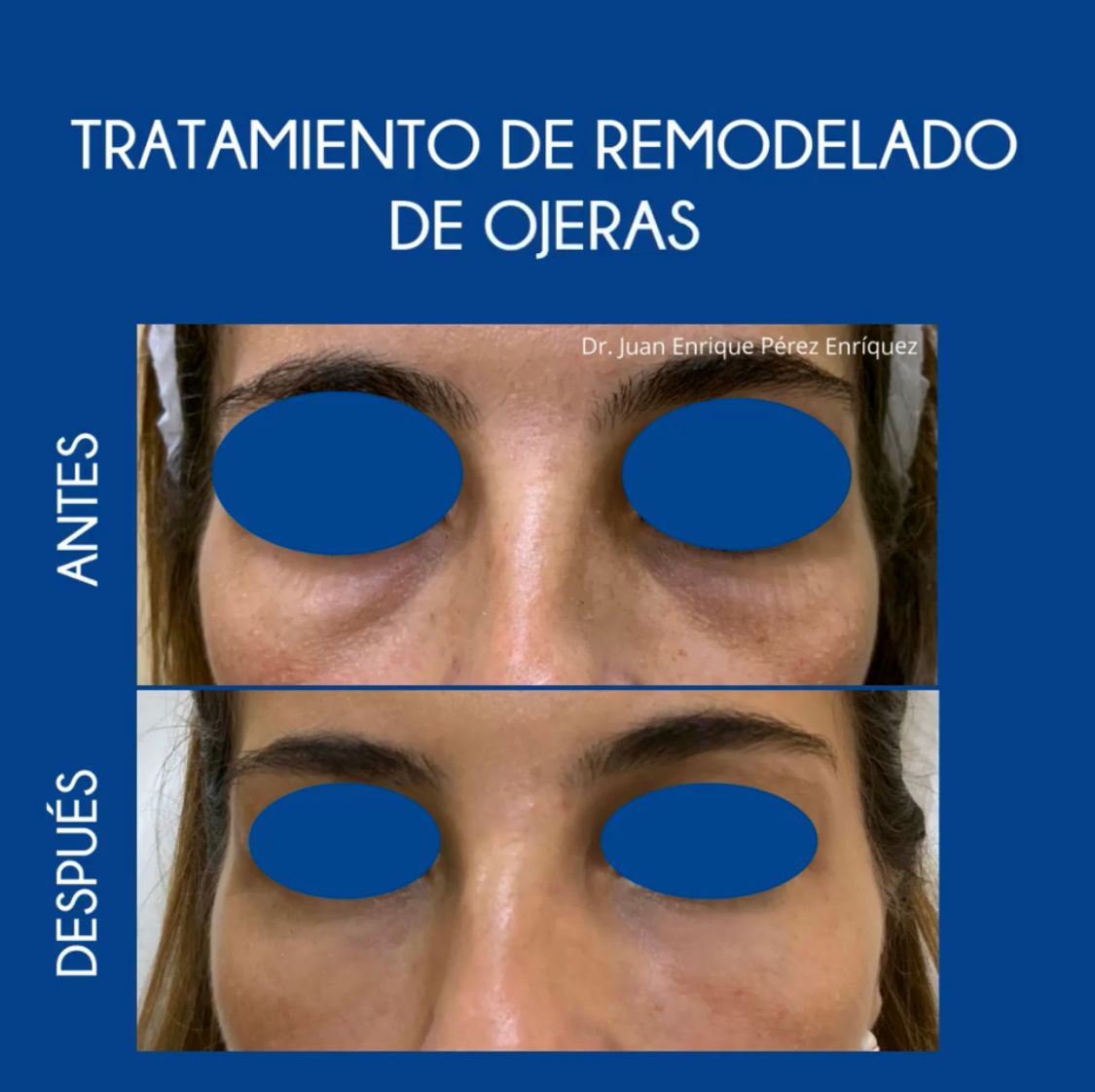 Juan Enrique Pérez Enríquez-16